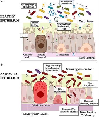 Interactions of Bacteriophages and Bacteria at the Airway Mucosa: New Insights Into the Pathophysiology of Asthma
